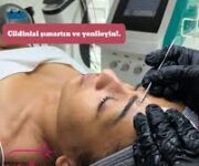 “Elif Beauty güzellik merkezinde profesyonel cilt bakımı ve estetik uygulamaları”