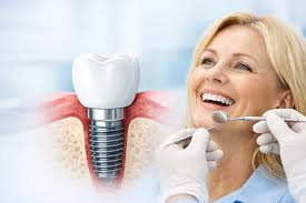 Neueste technologische Entwicklungen in der Zahnästhetik und Implantologie in Alanya