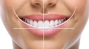 Digital Dentistry in Alanya: Revolutionary Advances in Implant Treatments