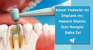 Alanya’daki modern diş kliniğinde 2026 yılına ait dijital teknolojilerle implant planlaması ve 3D görüntüleme yapılan bir tedavi ortamı.