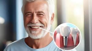 Alanya’daki modern diş kliniğinde dijital gülüş tasarımı ve implant planlaması bilgisayar ekranında detaylı şekilde gösteriliyor.