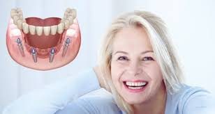 Miksi moderni hammasklinikka Alanyassa, jossa potilas saa hoitoa ja taustalla kustannusetuja kuvaava vertailuteema