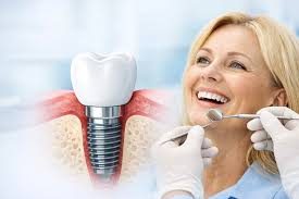 Neueste technologische Entwicklungen in der Zahnästhetik und Implantologie in Alanya